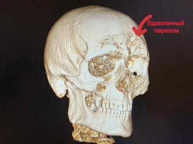 � ��������� ������������� �������������� �������� �� ��������� ��������� ��������� �������� � ������� ���������