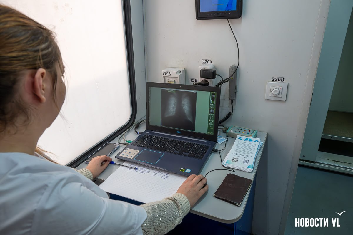 Флюорография в автобусе: на остановке «Калина Молл» на выходных можно будет проверить лёгкие Флюорография в автобусе: на остановке «Калина Молл» на выходных можно будет проверить лёгкие