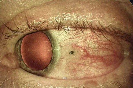 ������ �������� ����� ��������� ���� ��� ������ �� ������������ ������