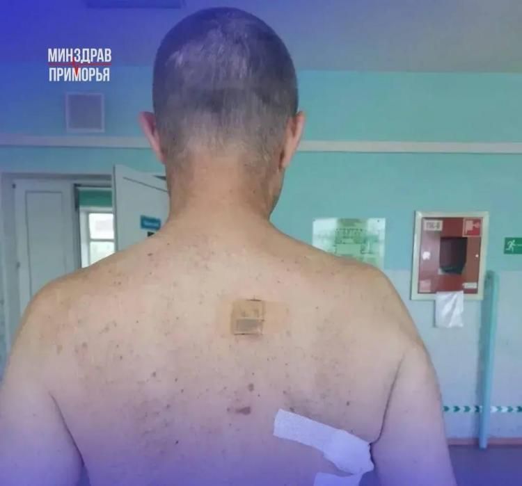 В Октябрьской районной больнице Приморья спасли мужчину с тяжёлым ножевым ранением