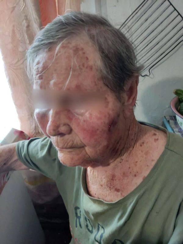 Подняли руку за дом: пенсионерку избили из-за доли в недвижимости в Приморье Подняли руку за дом: пенсионерку избили из-за доли в недвижимости в Приморье