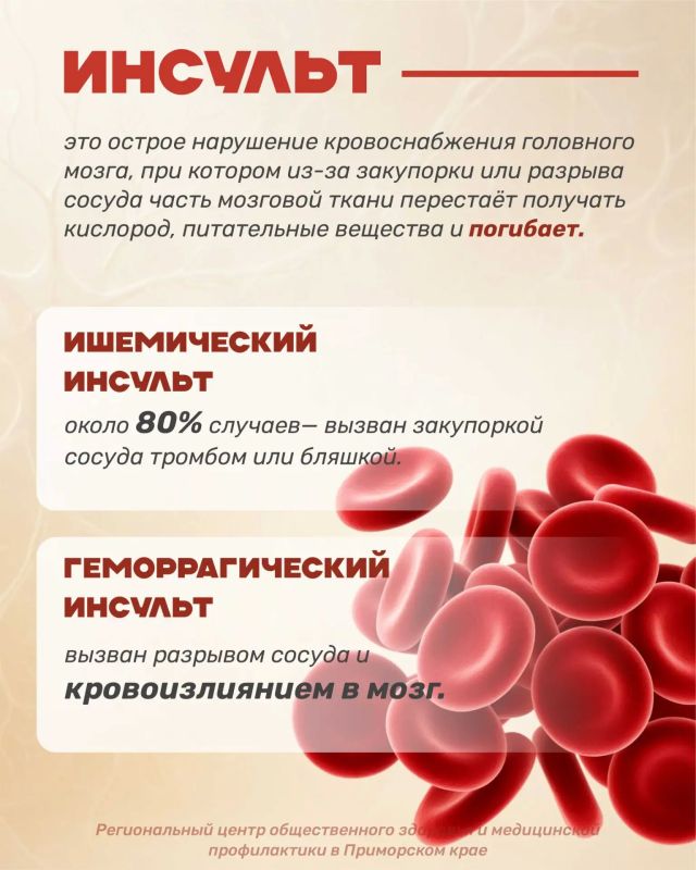 Инсульт — это серьезное заболевание, которое требует немедленного медицинского вмешательства Инсульт — это серьезное заболевание, которое требует немедленного медицинского вмешательства